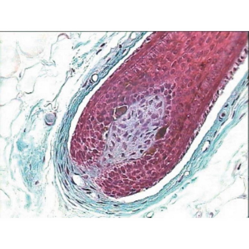 Human Scalp V.s.hair Insertion