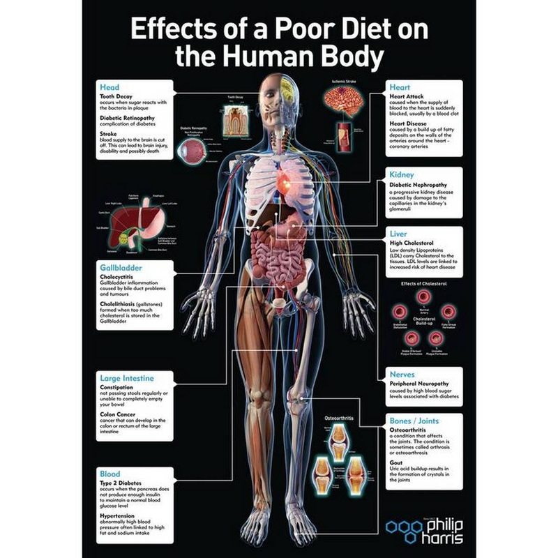 Effects Of A Poor Diet Poster